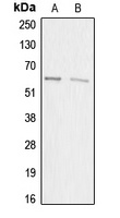 Anti-ACRBP Antibody