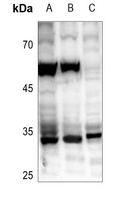 ZC3H8 antibody