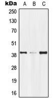 Anti-GPR174 Antibody