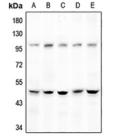 Anti-DGAT2 Antibody