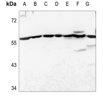 Anti-USP30 Antibody