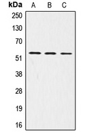 Anti-LRP11 Antibody