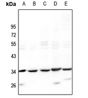 SLC25A21 antibody