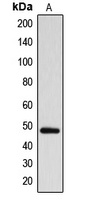 ARRDC1 antibody