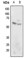 Anti-ARMC6 Antibody