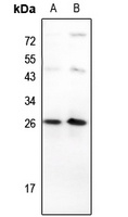 Anti-TP53INP1 Antibody