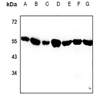 Anti-Alpha-tubulin 3C/D/E Antibody