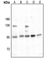 Anti-ESCO1 Antibody