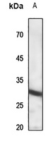 IL22 Receptor alpha 2 antibody