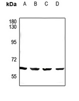 Anti-CDYL2 Antibody