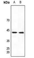 Anti-HEXIM2 Antibody