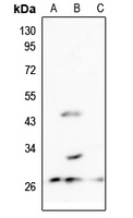Anti-MRPL10 Antibody