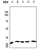 Apolipoprotein AI antibody