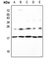 Anti-Neuromedin S Antibody