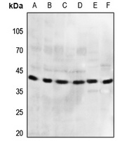 Anti-GPR175 Antibody