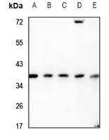 Anti-RNF113B Antibody