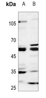 Anti-GCNT7 Antibody