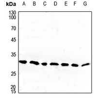 Anti-Cerebellin 4 Antibody