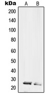 Anti-RPL10L Antibody