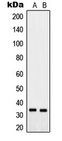 PTGR2 antibody