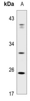 ABCC13 antibody