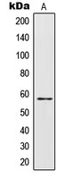 Anti-IL-28RA Antibody
