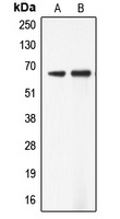 Anti-ADCK5 Antibody