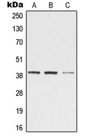 ZADH2 antibody