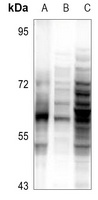 ZSCAN22 antibody