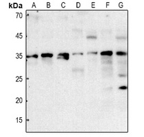 Aquaporin 12 antibody