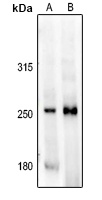 Anti-MAST4 Antibody