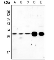 LDLRAD2 antibody