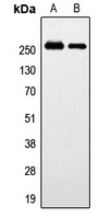 Anti-GPR179 Antibody
