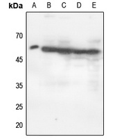 Anti-p47 phox (Phospho-S370) Antibody