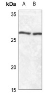 Anti-SFTPA1/2 Antibody