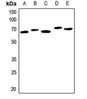 SERPINA3 antibody