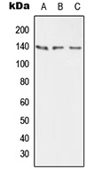Anti-PMCA2 Antibody