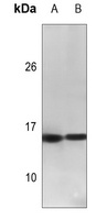 CGRP antibody