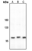 Anti-CLCN1 Antibody