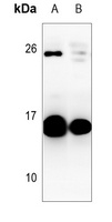 CSF2 antibody