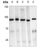 Anti-CD105 Antibody