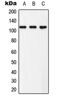 Anti-EPHB3 (Phospho-Y608) Antibody