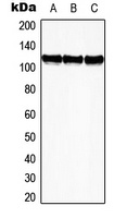 Anti-EPHB3 Antibody