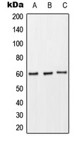 Anti-CD89 Antibody