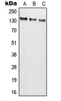 Anti-NMDAR2C Antibody