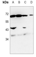 Anti-NRG1 Antibody