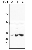 HLA-DQB2 antibody