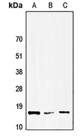 Anti-HMGN1 Antibody