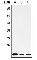Anti-ATP8 Antibody