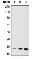 Anti-MTH1 Antibody